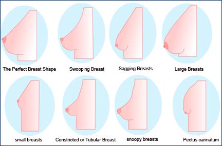 Breasts Types  Types of Breasts